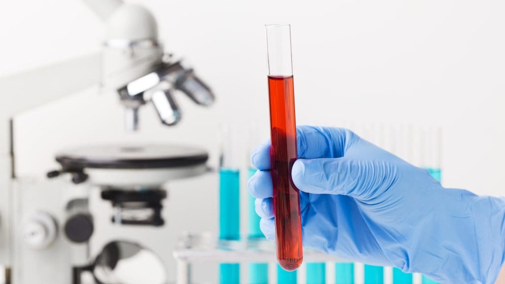 What Doctors Deal With Thalassemia? 1 What Doctors Deal With Thalassemia