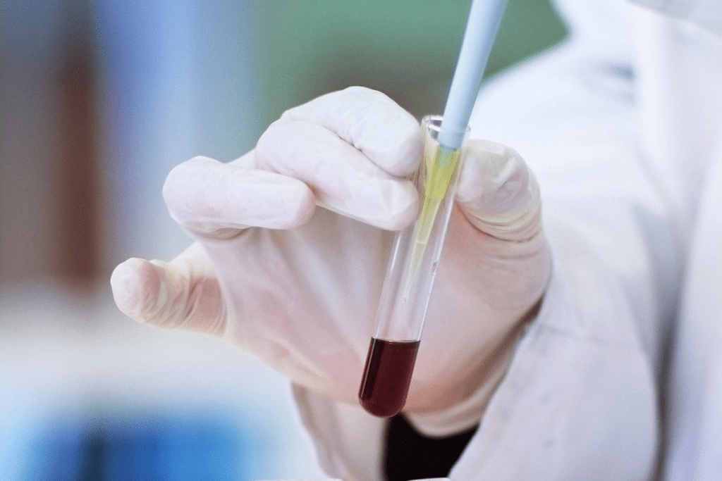 Vital Reasons to Visit a Trusted Hematology 2 Vital Reasons to Visit a Trusted Hematology