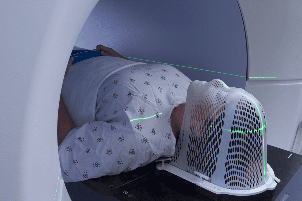 At What Stage of Cancer Is Radiotherapy Used?