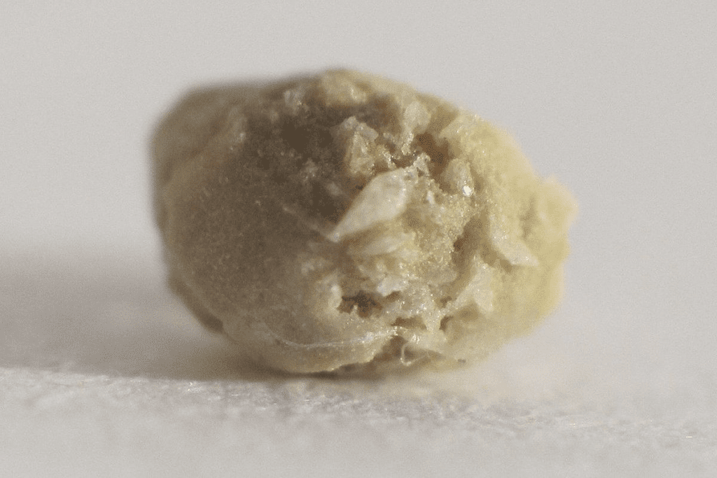 Oxalate: The Ultimate Low-Oxalate Veggie Guide 2 Oxalate: The Ultimate Low-Oxalate Veggie Guide