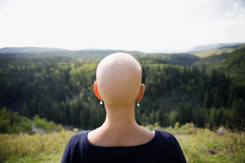 Anticipating Chemo Hair Loss: What to Expect 1 Best Foods: what to eat after chemo