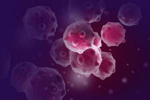 Ovary Removal Ovarian Cancer Cure: Is it Effective?