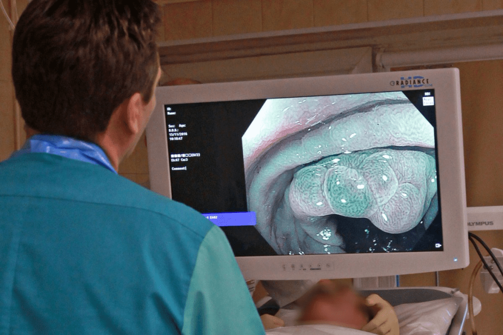 Colonoscopy vs. prostate exam procedure