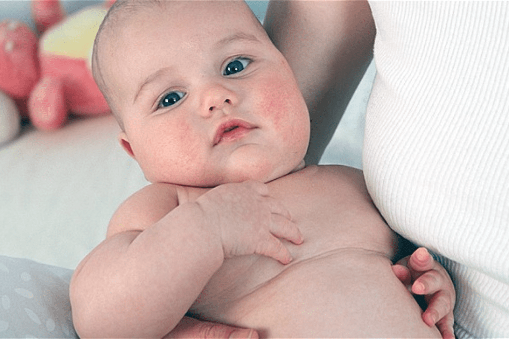 Childhood Obesity: Disorders That Cause It Explained