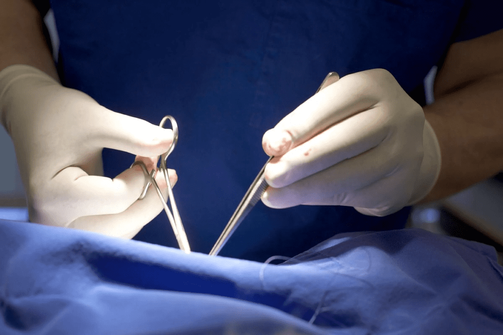 Urethroplasty Pain: How Bad is the Negative Post-Op Pain?