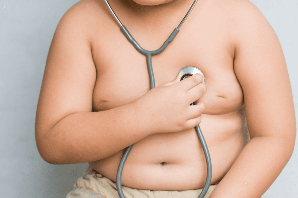 Childhood Obesity: Main Causes Parents Must Know