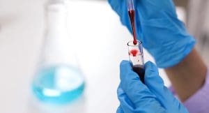 Which Blood Diseases Have No Cure? Understanding Incurable Blood Disorders