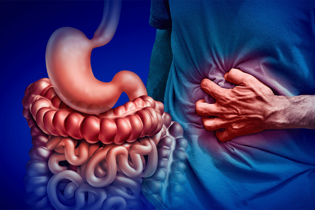 AVM: Critical Congenital Disorder of Intestinal Nerves 1 AVM: Critical Congenital Disorder of Intestinal Nerves