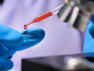 How to Diagnosing Hematologic Disorders Accurately