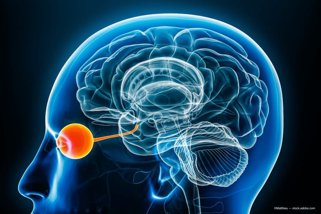 Chiari Malformation in Pediatrics: Essential Guide 2 Chiari Malformation in Pediatrics: Essential Guide