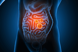 AVM: Understanding the Shocking Facts About GI Arteriovenous Malformation