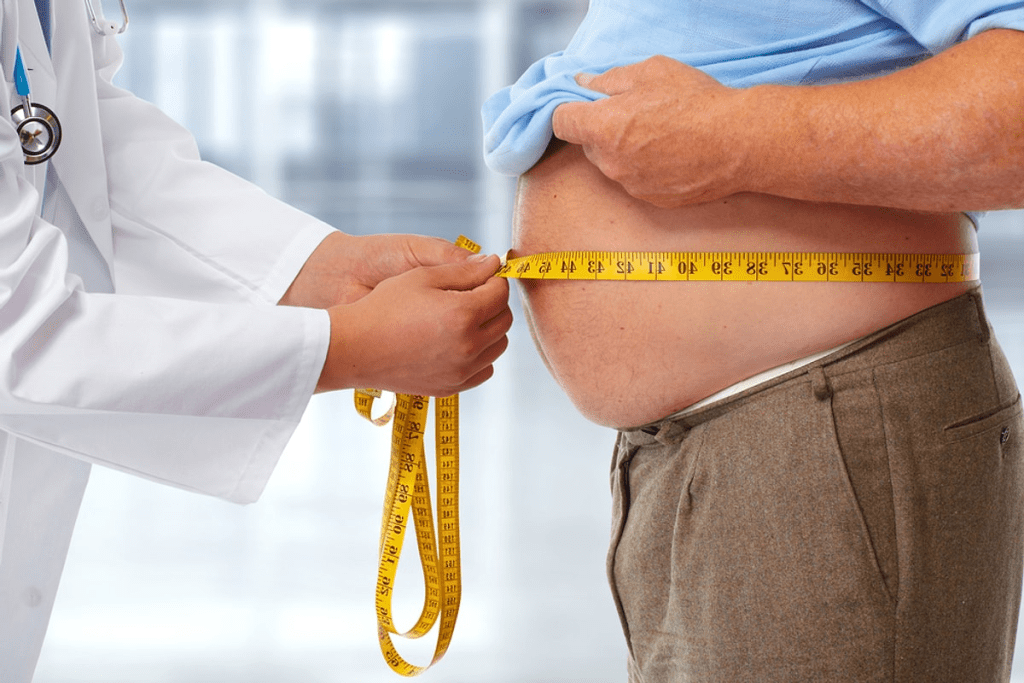 ABCD Obesity Alternative: Smarter Health Term