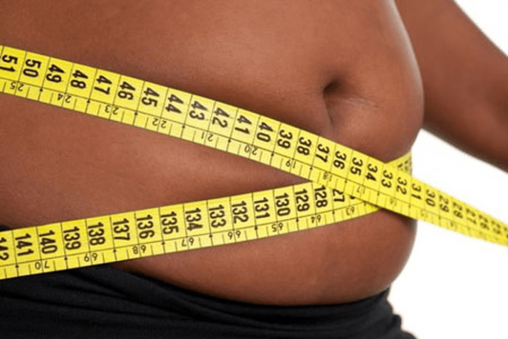 ABCD Obesity Alternative: Smarter Health Term