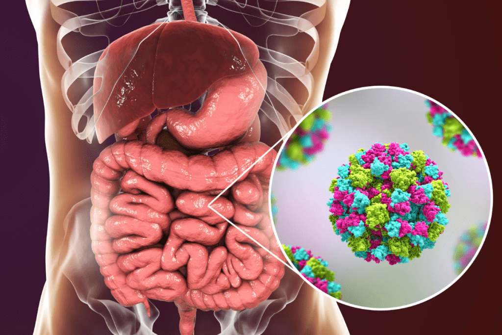 Childhood Gastroenteritis: Shocking Top Cause Revealed