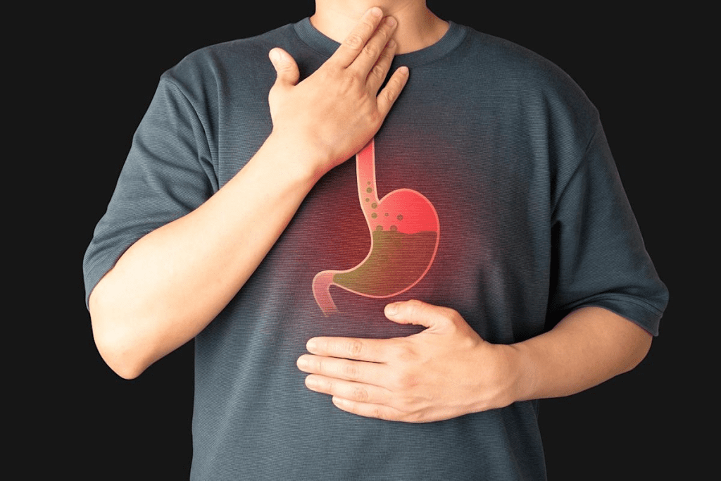 Gastrointestinal Disease: 4 Common Disorders