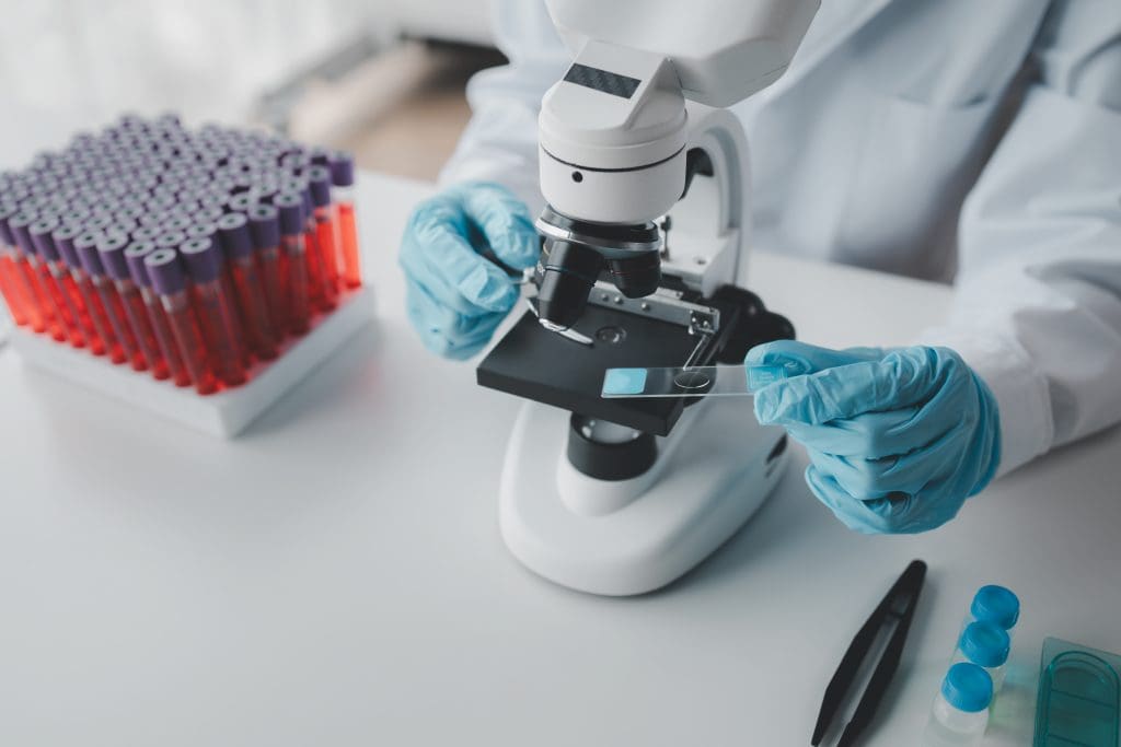 Bruising in Children Blood Disorders