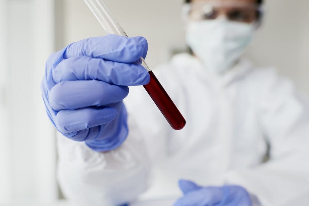 Hematologist Oncologist: Do Oncologists Also Specialize in Hematology? 1 Hematologist Oncologist