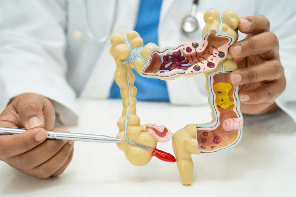 Appendicitis Treatments: Powerful Non-Surgical Options Explained