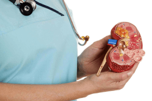 Can Women Get Kidney Stones? Best Pregnancy Guide