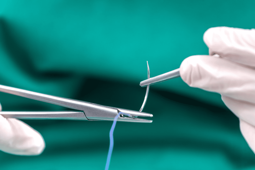 Urethral Stricture Surgery: How Bad is the Procedure? 3 Urethral Stricture Surgery: How Bad is the Procedure?