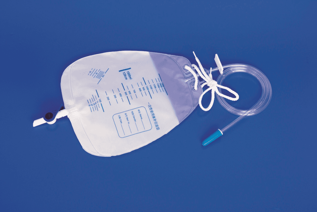 Suprapubic Catheterization: Most Common Bladder Surgery 3 Suprapubic Catheterization: Most Common Bladder Surgery