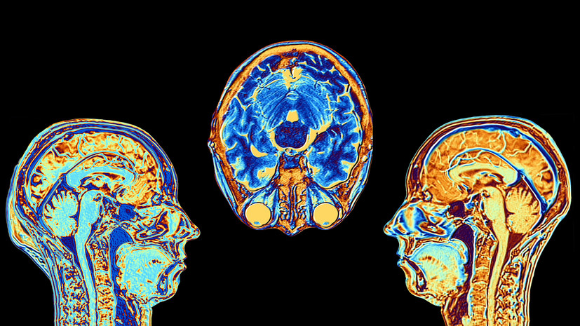 Why Would a Doctor Order an MRI of the Brain? 3 Why Would a Doctor Order an MRI of the Brain?