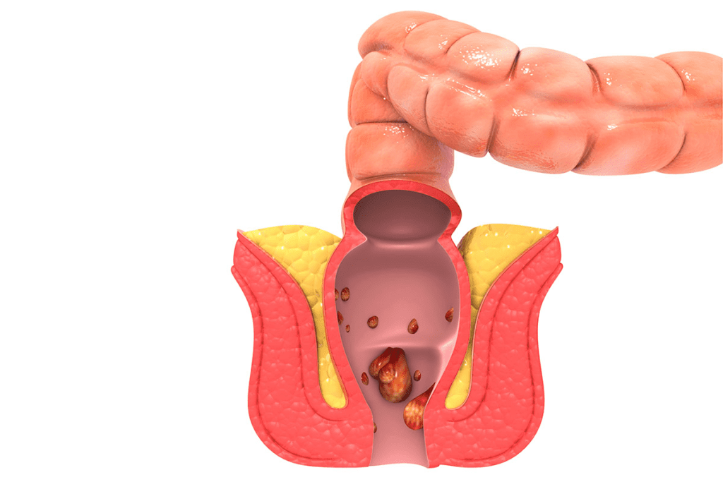 Recognizing Changes: What Does Early Peyronie's Disease Look Like? 2 Recognizing Changes: What Does Early Peyronie's Disease Look Like?