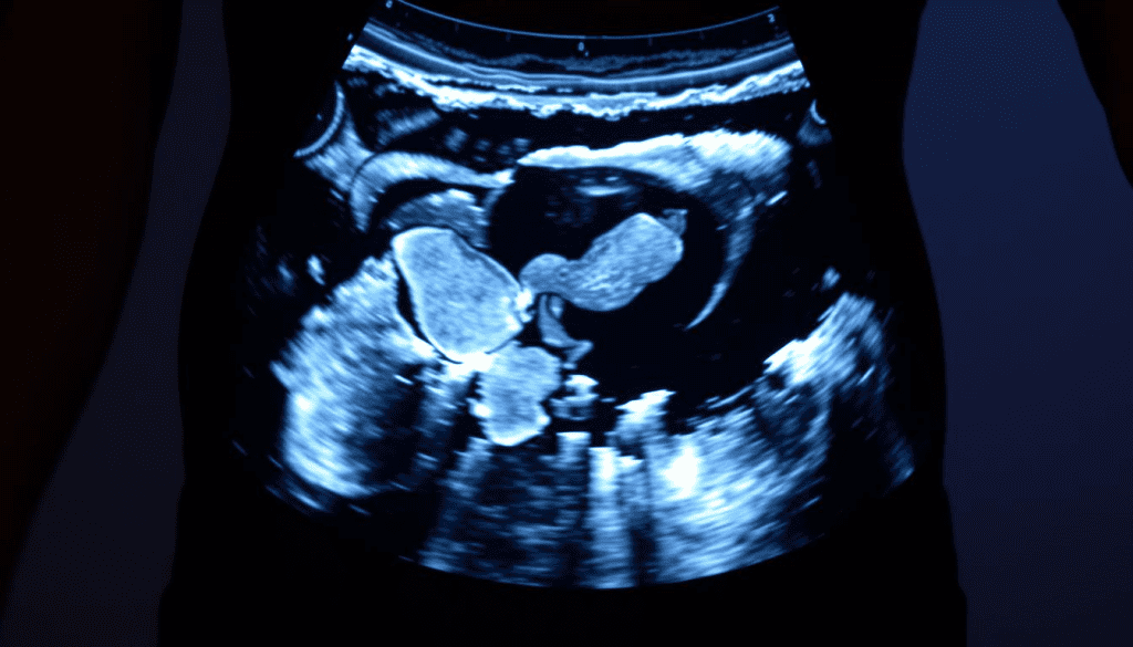 Pelvic Ultrasound: Eating Before Exam