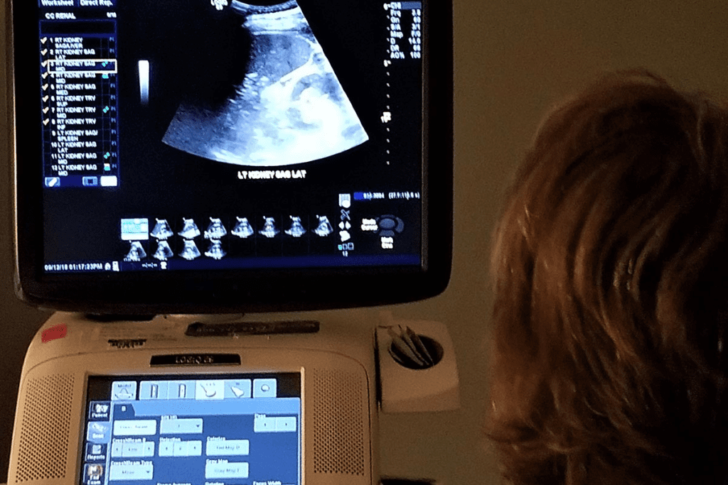 Urological Ultrasound Explained: What Does it Show?