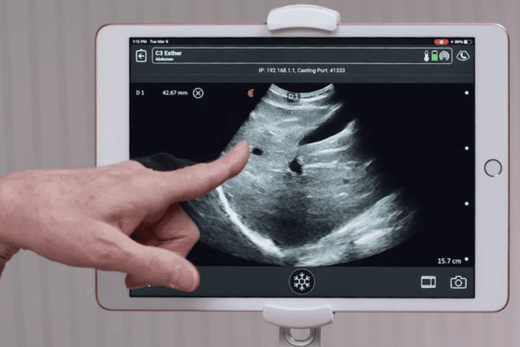 Uroflowmetry vs. Bladder Sonogram: Shocking Differences Explained 1 Uroflowmetry vs. Bladder Sonogram: Are They the Same?