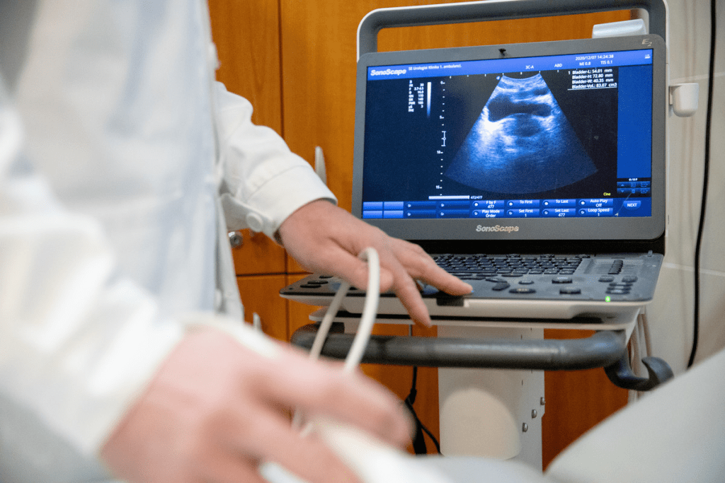 Reasons Why a Urologist Orders an Ultrasound Scan 1 Reasons Why a Urologist Orders an Ultrasound Scan