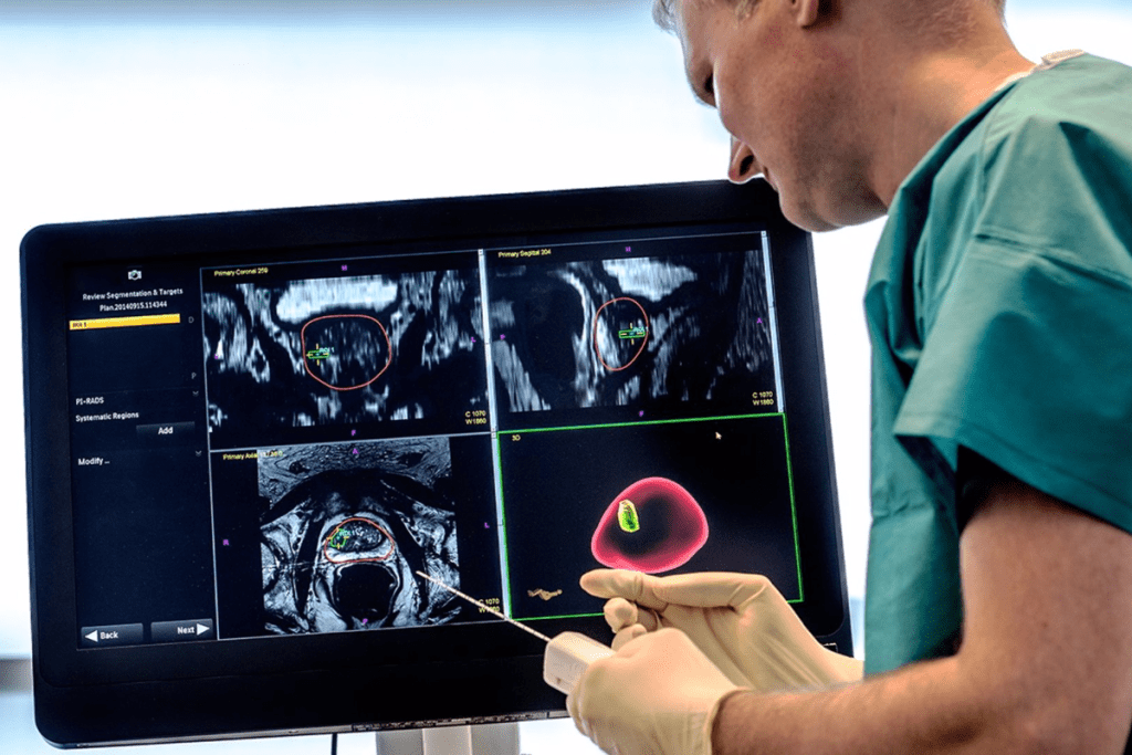 Prostate MRI: Crucial Time for Urology Scan 1 Prostate MRI: Crucial Time for Urology Scan