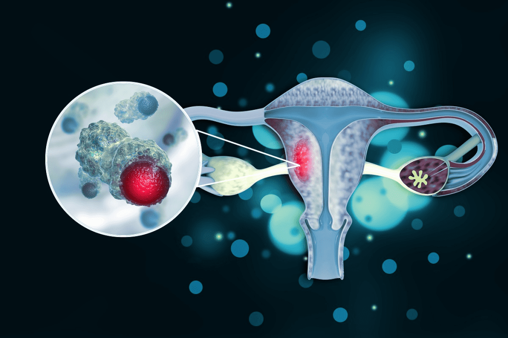 Bladder Cancer: Amazing Latest Treatment Options