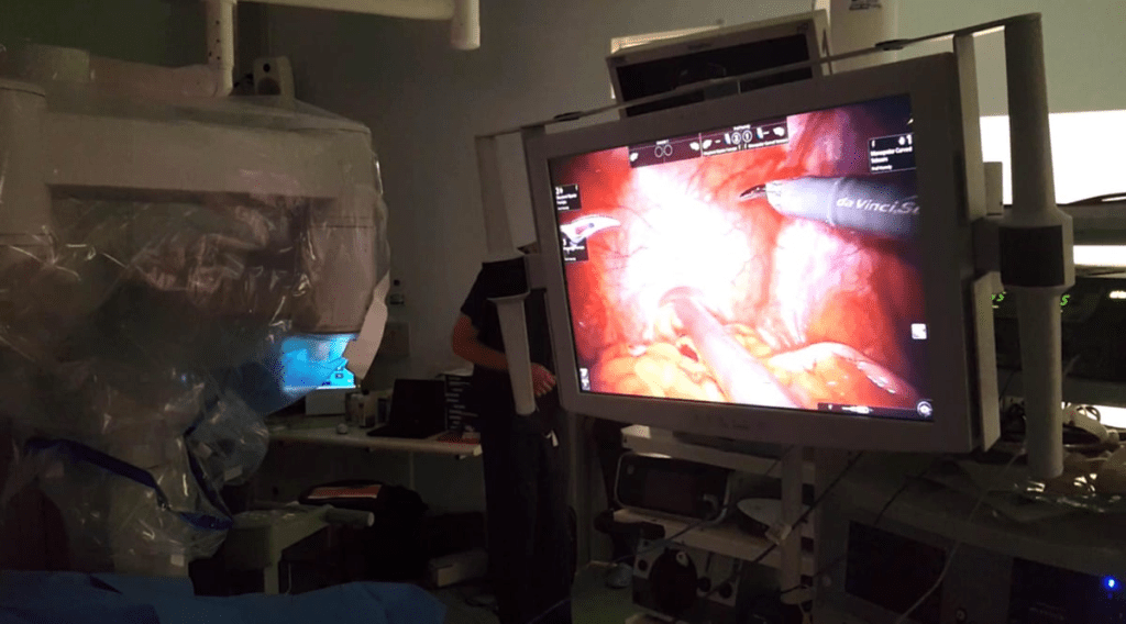 Powerful CT Scan Cancer Detection and Ultrasound: Can Ultrasound Truly Detect Bladder Cancer?

