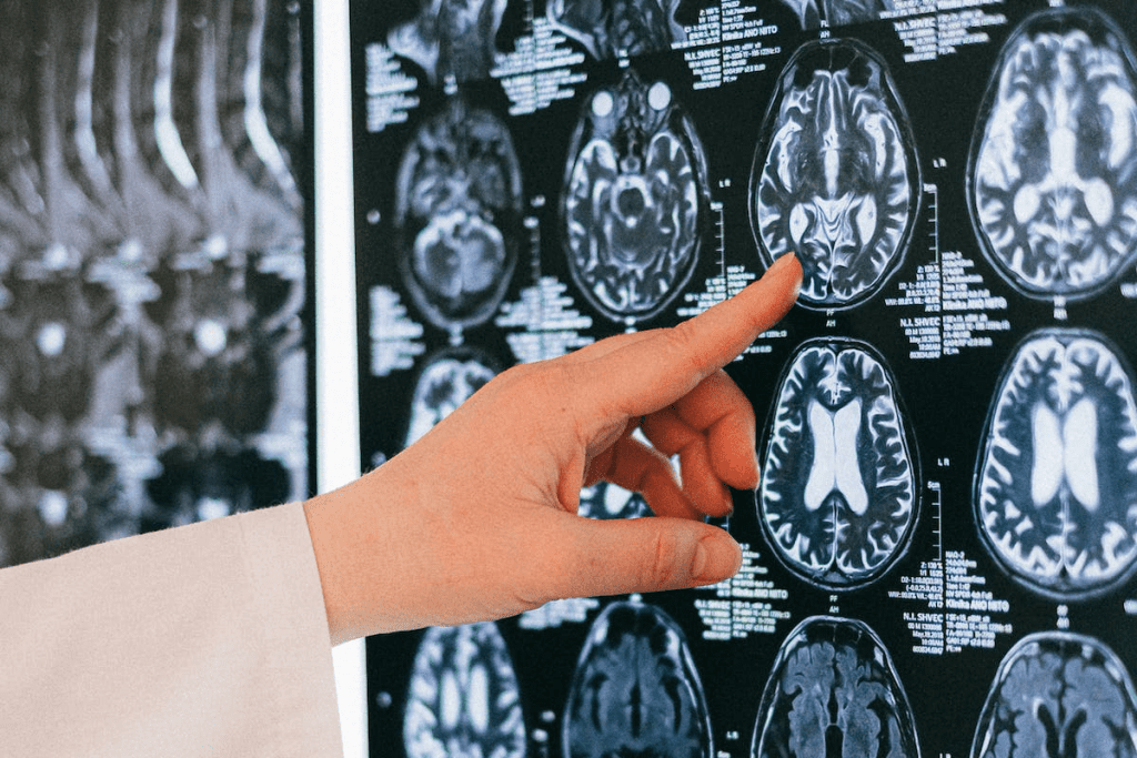 Neurological Disorders: Symptoms to Worry About 3 Neurological Disorders: Symptoms to Worry About