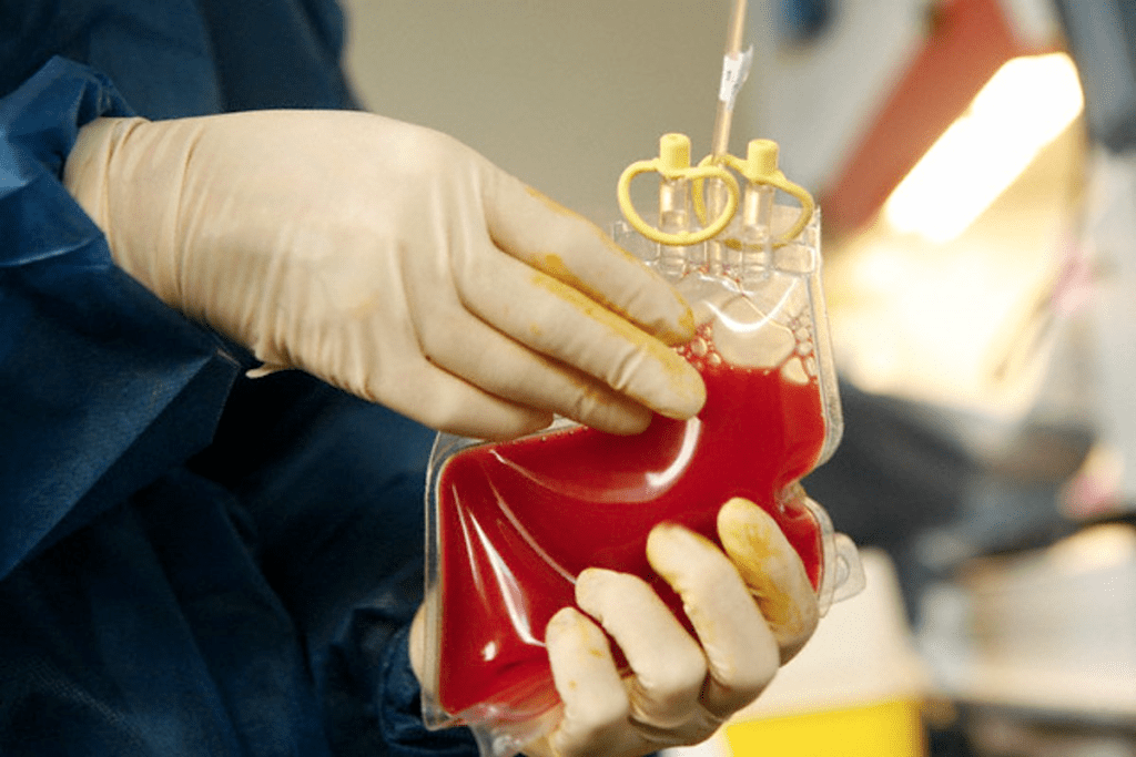 Eligibility: stem cell transplant contraindications That Disqualify You 3 image 1153 LIV Hospital