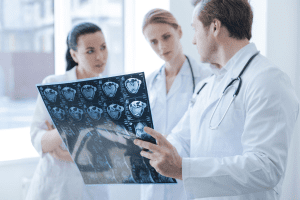When Should You See A Neurologist? Consult Facts