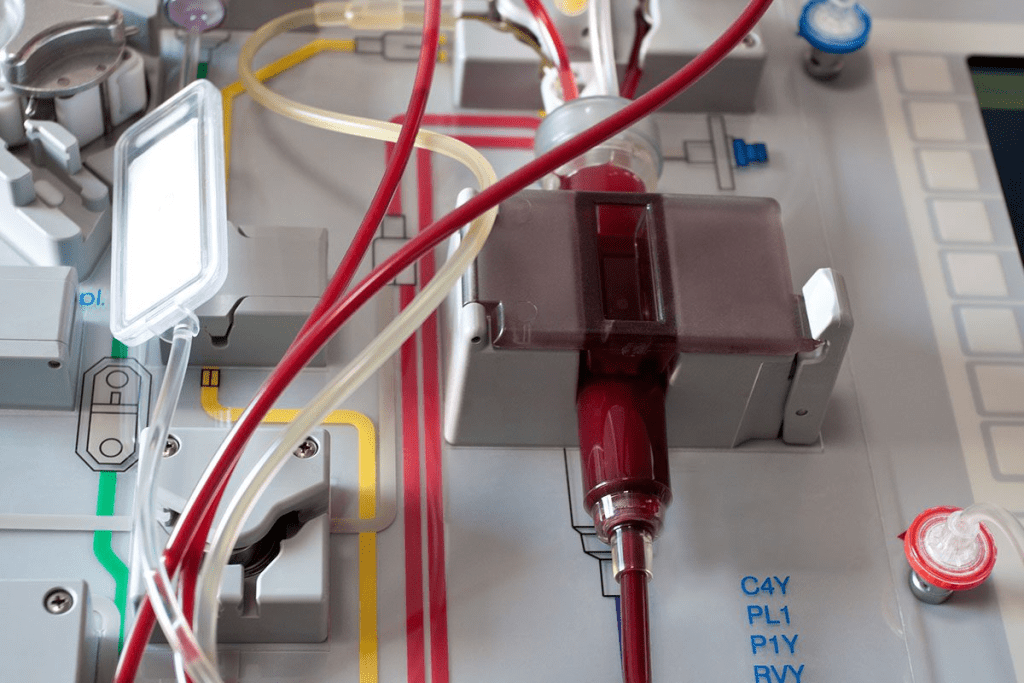 Eligibility: Who is Not a Candidate for stem cells Transplant?