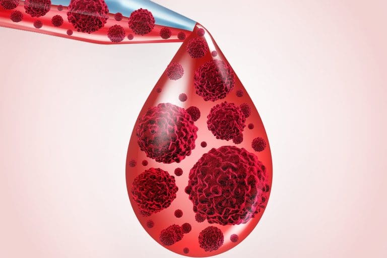 Blood Test for Cancer: Amazing Diagnostic Facts