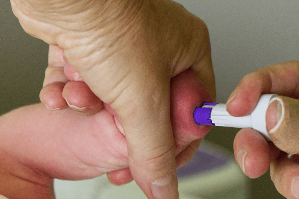 Blood Transfusion for Anemia: Pediatric Guidelines 2 Blood Transfusion for Anemia: Pediatric Guidelines