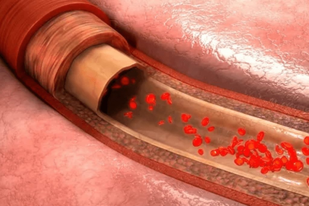 Alternatives to Blood Transfusion: Options 3 Alternatives to Blood Transfusion: Options