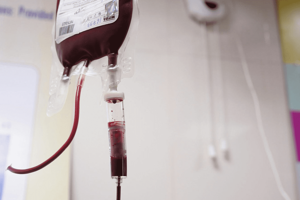 Alternatives to Blood Transfusion: Options 1 Alternatives to Blood Transfusion: Options
