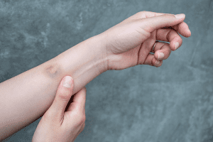 Bruising Easily: Dangerous Leukemia Bruise Sites