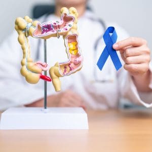 What is the ICD-10 Code for Colon Cancer?