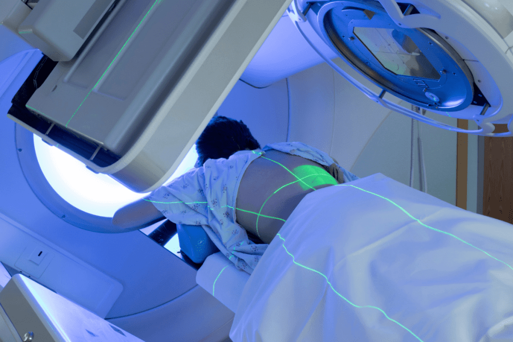 The Major radiation side effects: A Guide to Permanent Damage 2 The Major radiation side effects: A Guide to Permanent Damage