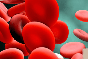 Does Leukemia Cause Anemia? Shocking Hemoglobin Data Revealed