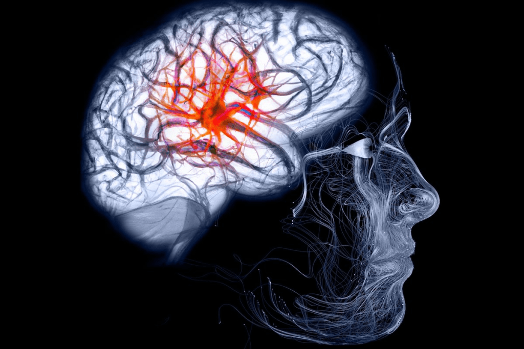 Brain Fog And Chemo: Crucial Brain Impact 3 Brain Fog And Chemo: Crucial Brain Impact