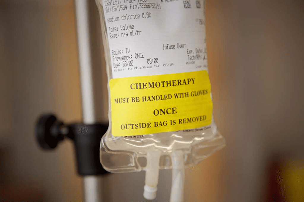 Brain Fog And: Terrible Chemo Brain Explained