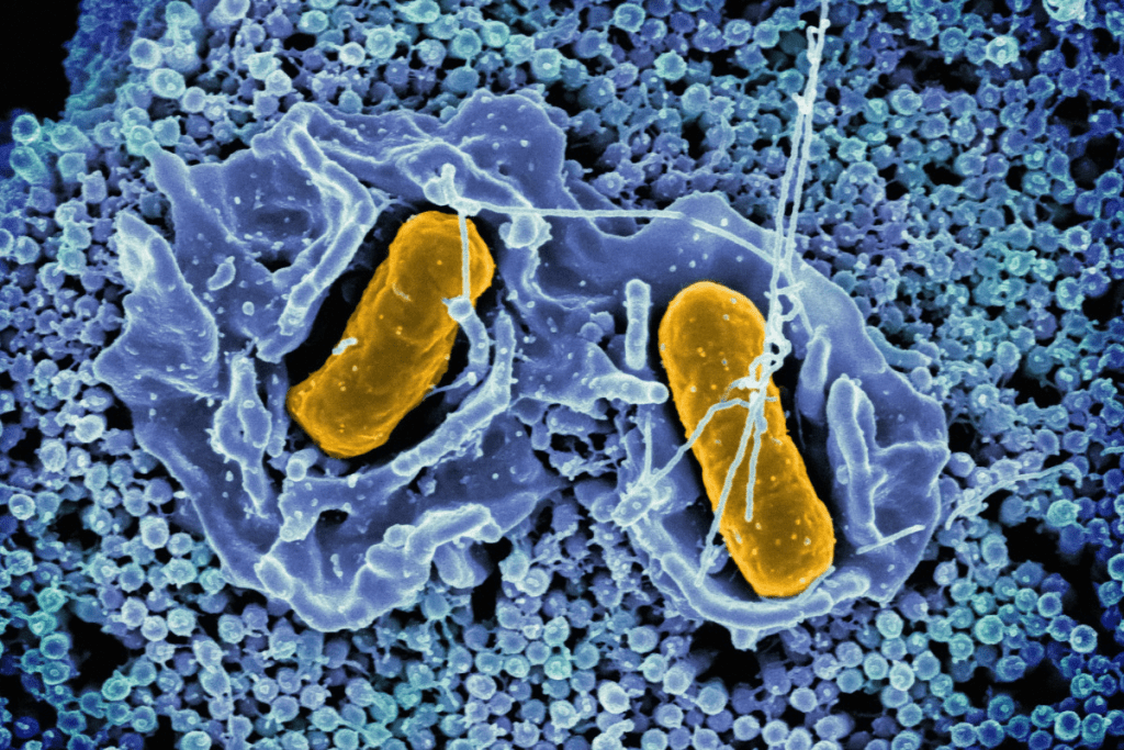 Understanding Bubble Baby Syndrome: Symptoms, Causes, and scid