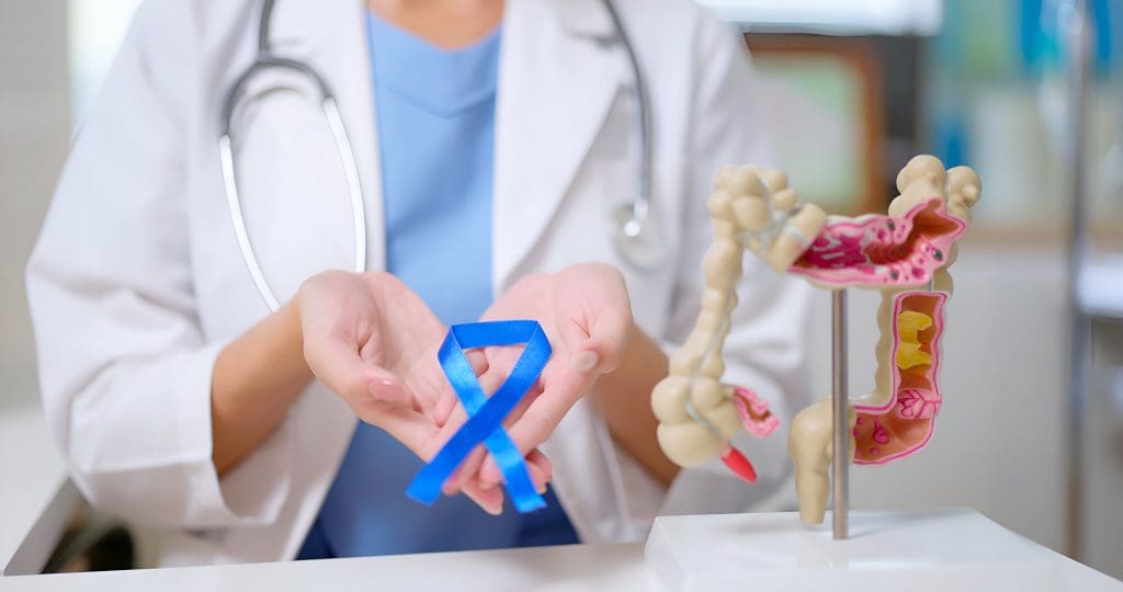 How to Check at Home If You Have Colon Cancer? 1 How to check at home if you have colon cancer